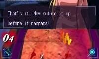 Trauma Center – Under the Knife (Europe) (En,Fr,De,Es,It)